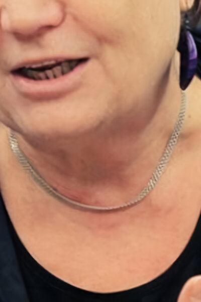 Případ pro ombudsmanku